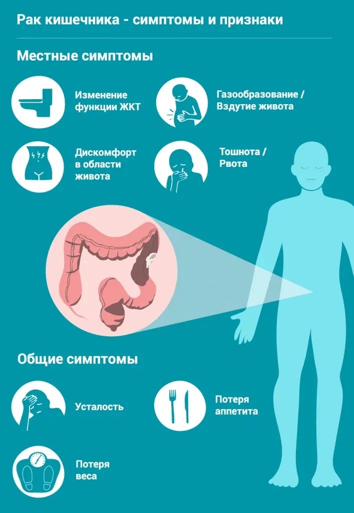 Признаки рака кишечника у мужчин на ранних. Опухоль кишечника симптомы. Онкология прямой кишки симптомы.